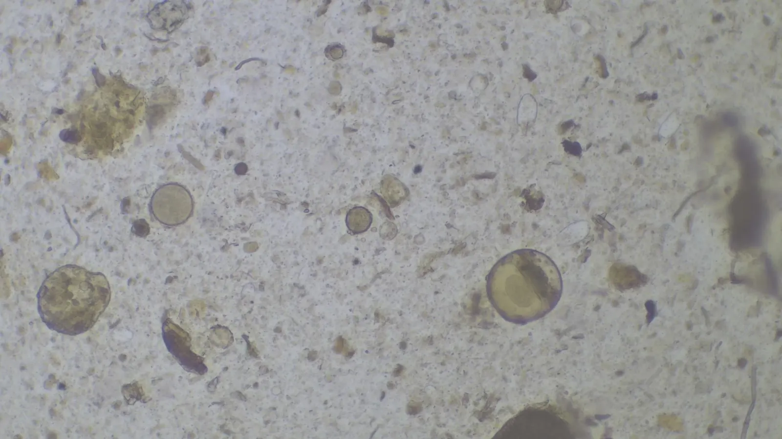 Microscope view of soil microorganisms